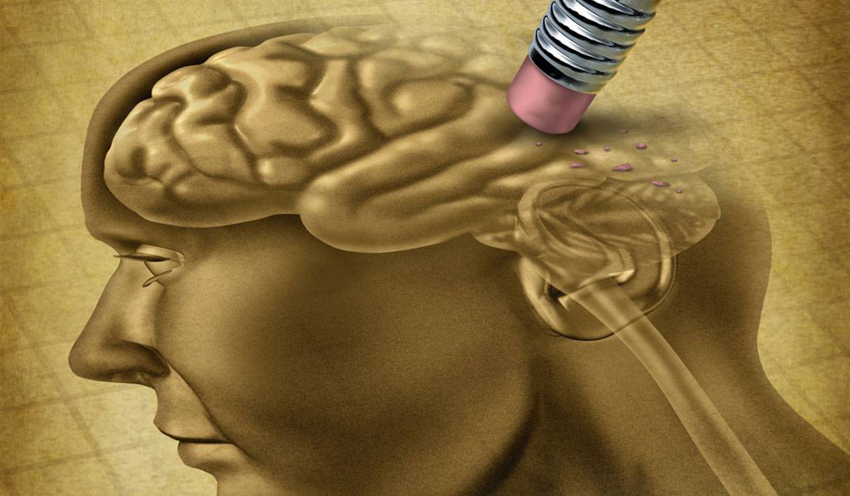 ضغف الذاكرة 