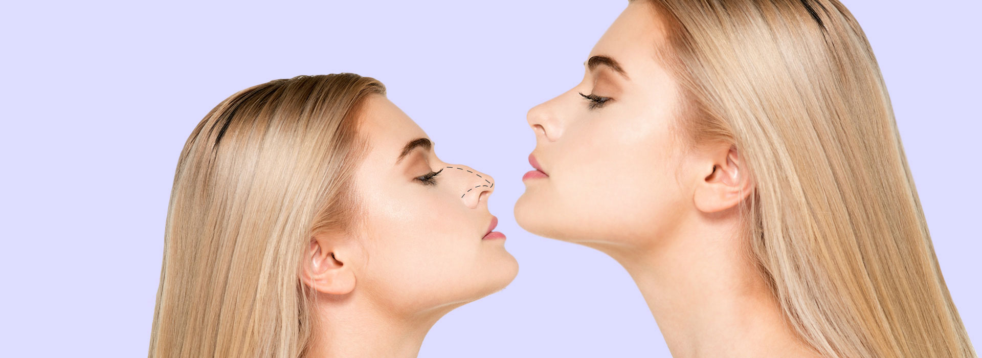 عمليات تجميل الأنف 