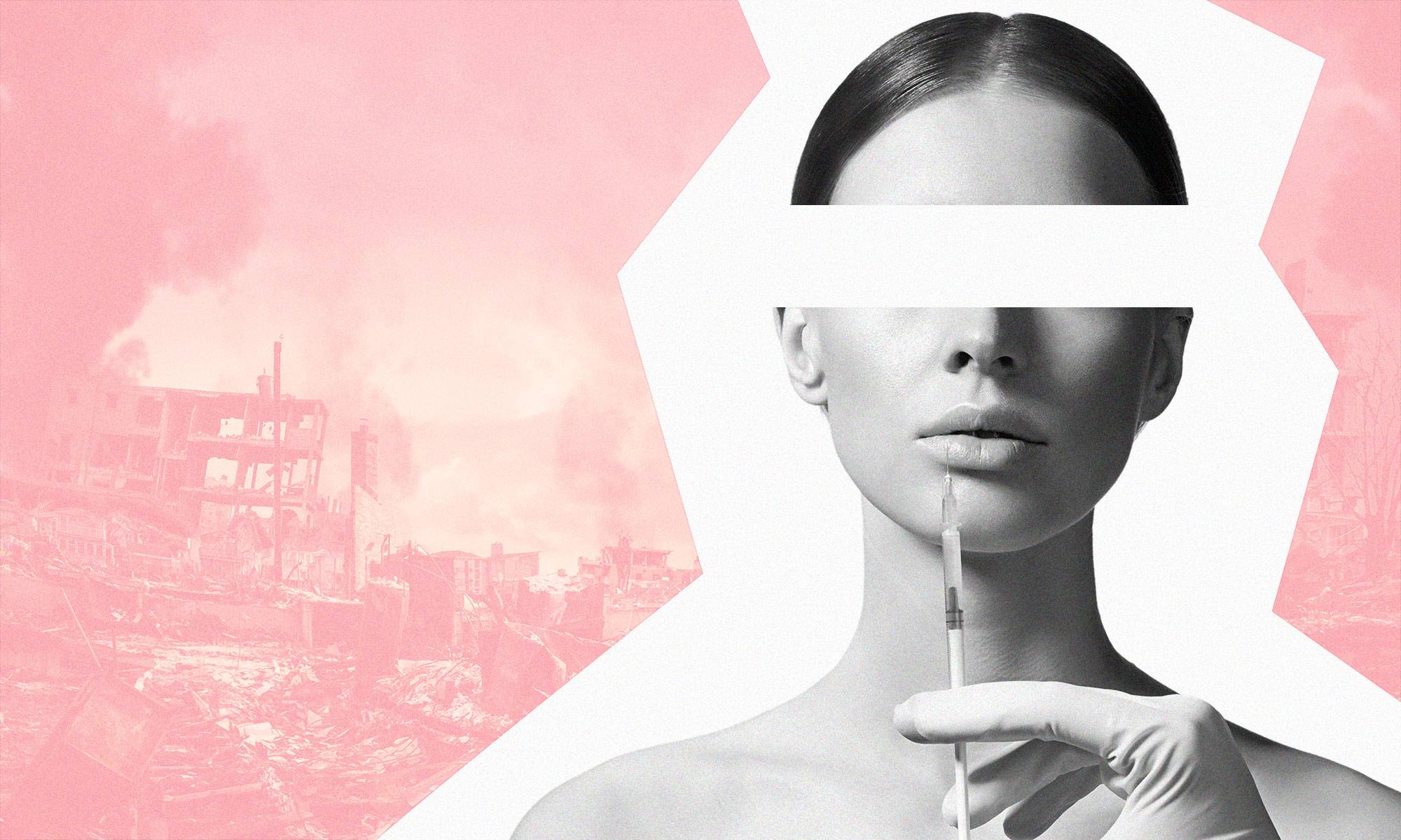 تجميل الأنف 