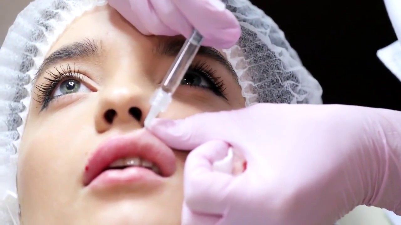 فترة النقاهة بعد عملية تجميل الأنف