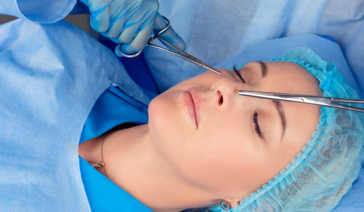 تجميل الأنف العريض جراحيًا