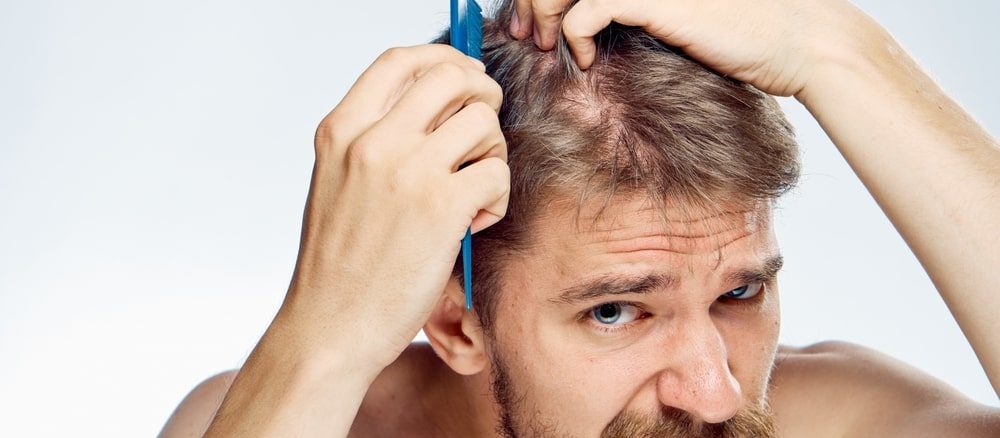 اسباب تساقط الشعر عند الرجال