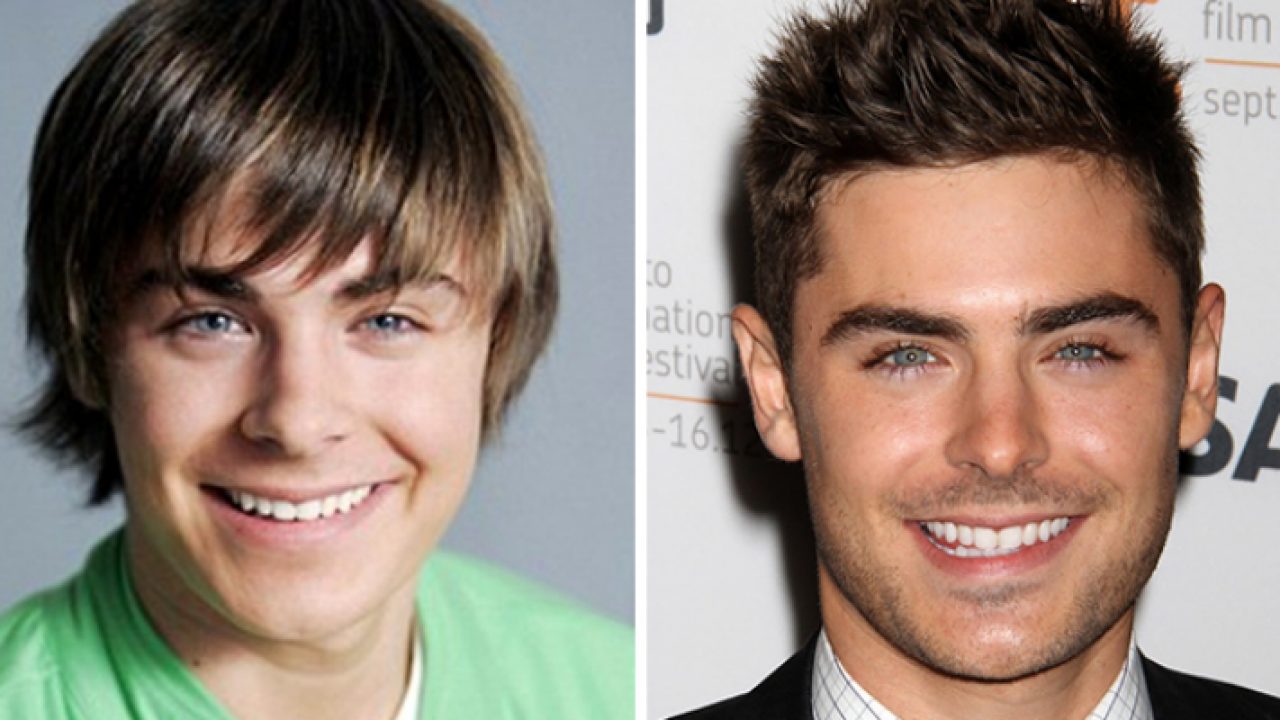 عمليات تجميل الأنف العريض والكبير الحجم 