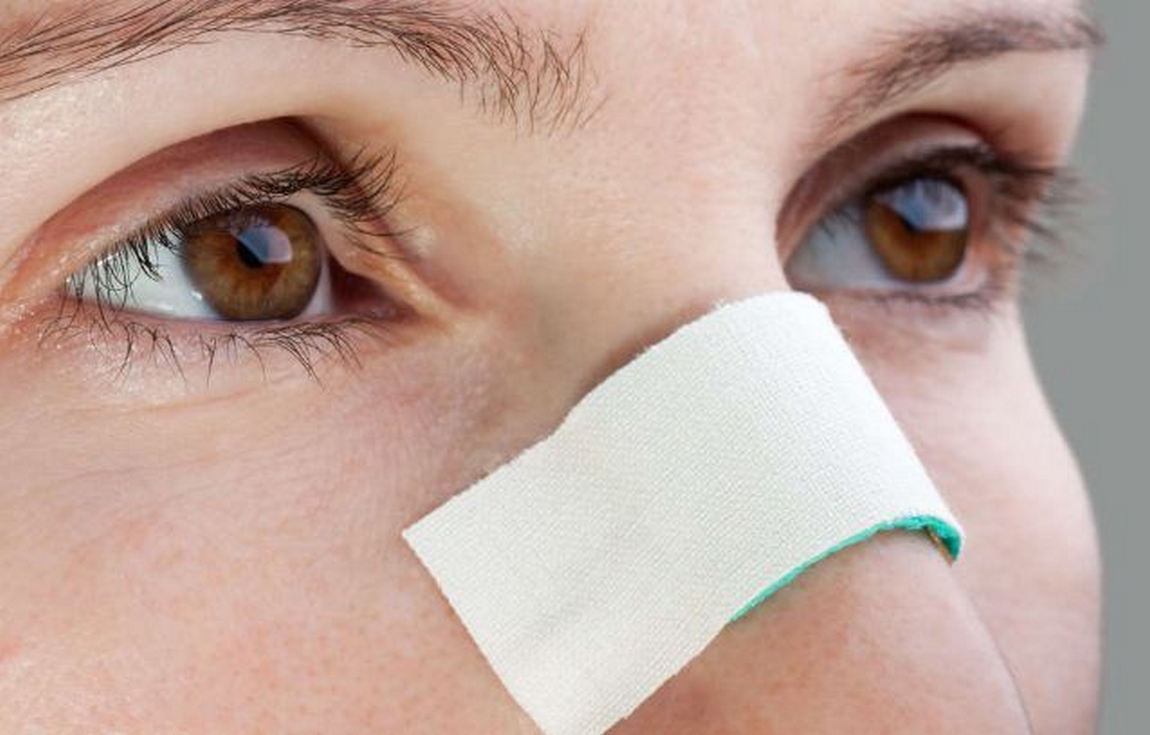  عملية تصغير أرنبة الأنف بالتخدير