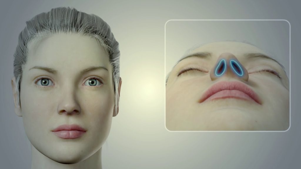 خطاء عمليات تجميل الانف