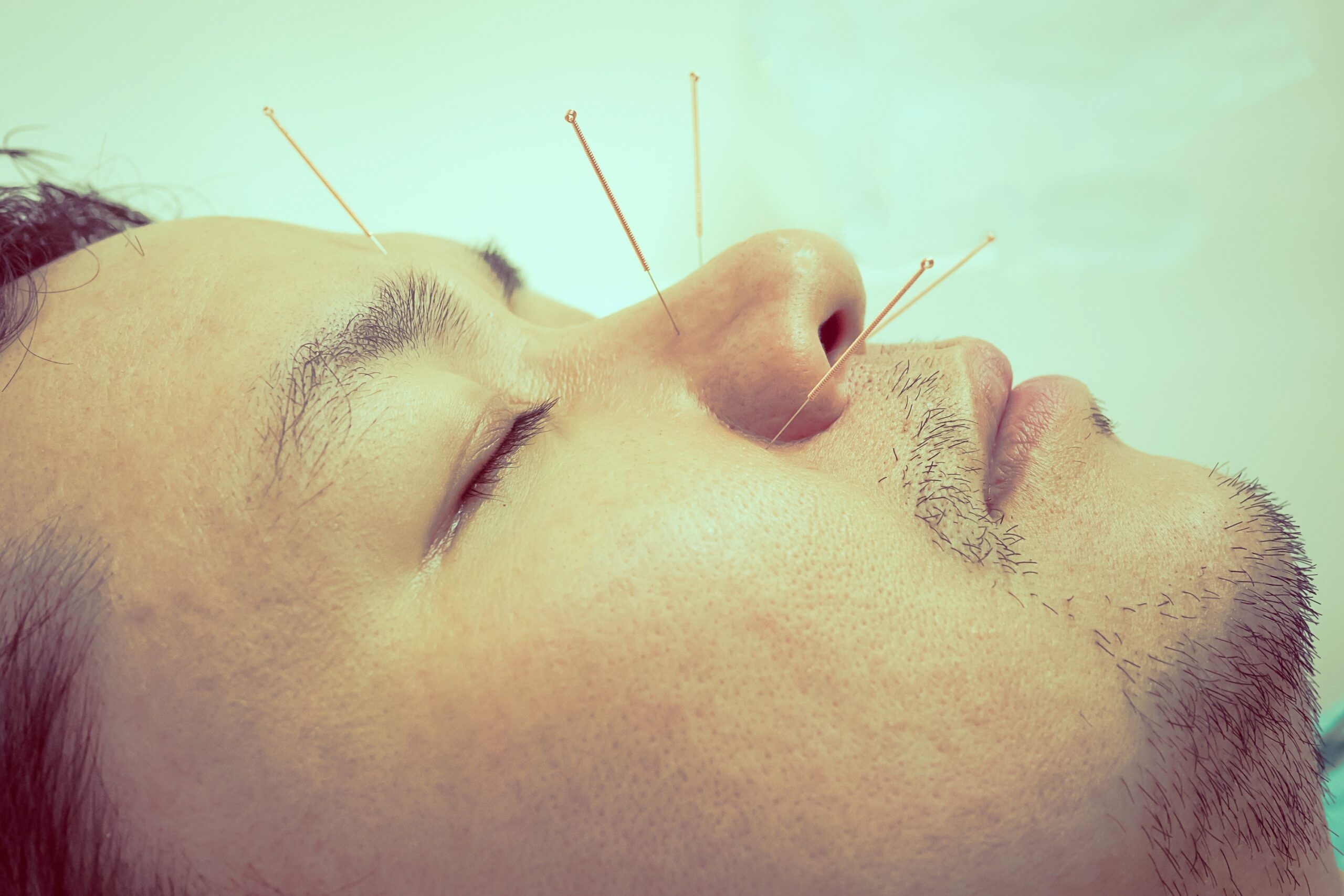 تجميل وتنحيف الأنف العريض 