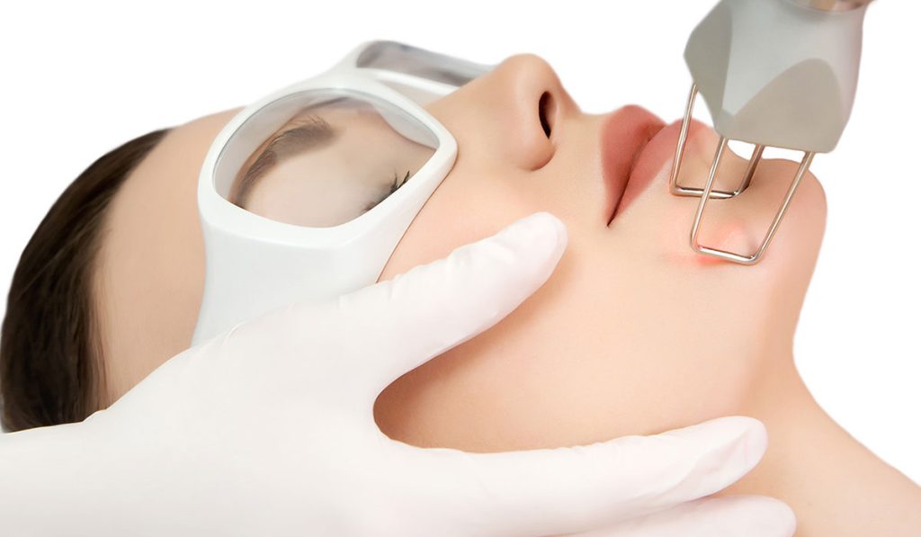 كم جلسة ليزر يحتاج الجسم لازالة الشعر