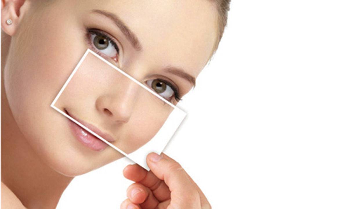 عملية تجميل الأنف
