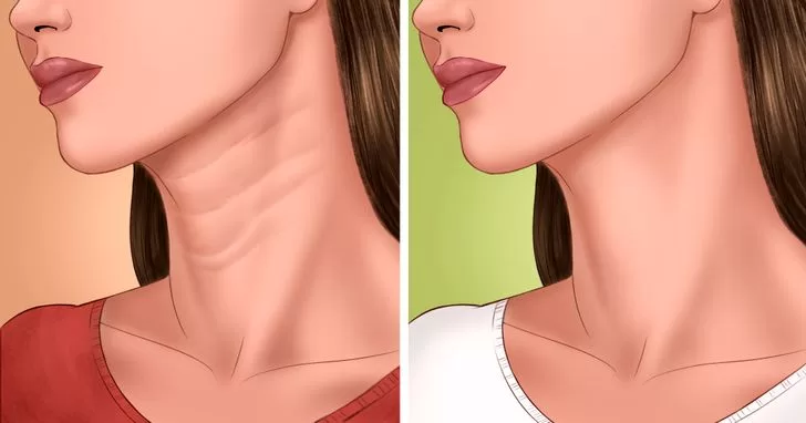 خطوط الرقبة والحمل