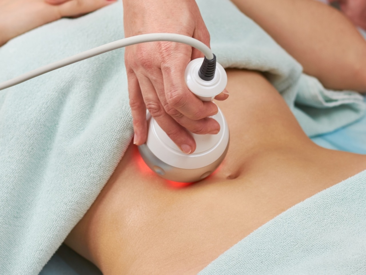 شد ترهلات البطن بالليزر