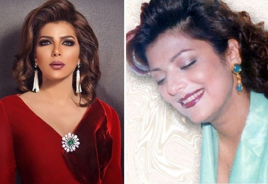 الفنانات قبل وبعد عملية تجميل الانف