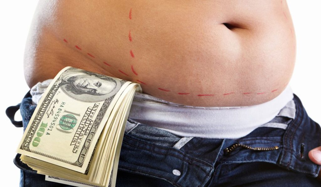 أسعار عمليات نحت الجسم