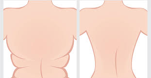 كيفية التخلص من دهون الظهر