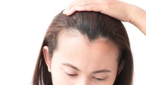 زراعة الشعر عن طريق الاستنساخ