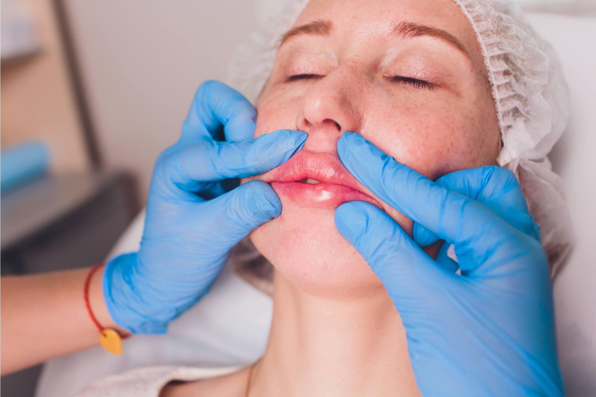 أفضل مرطب للشفايف بعد الفيلر