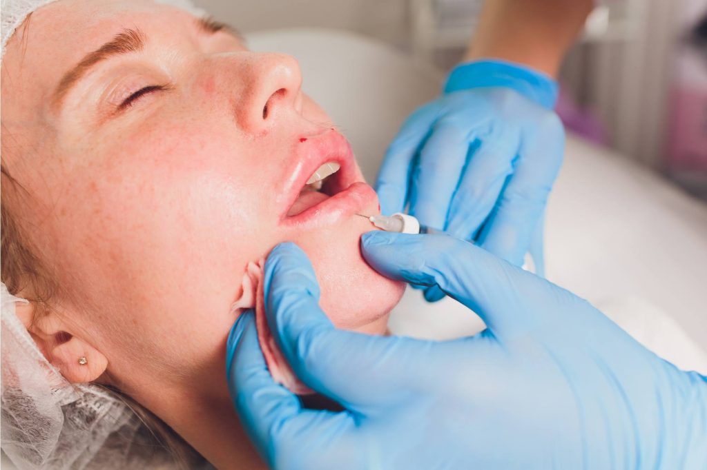 أفضل مرطب للشفايف بعد الفيلر