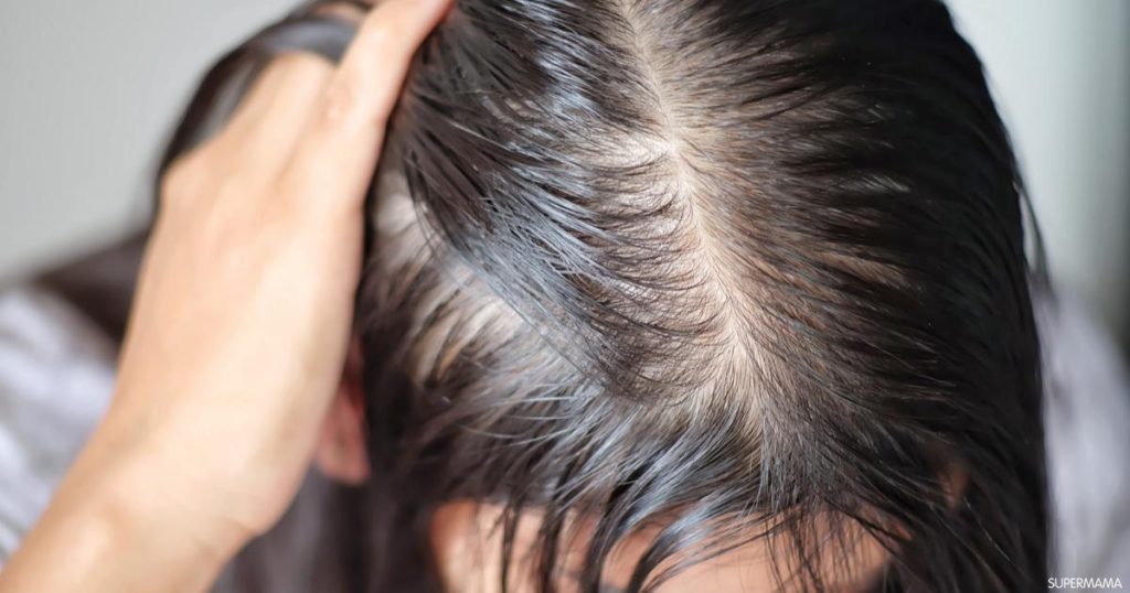 متى تثبت البصيلات بعد زراعة الشعر
