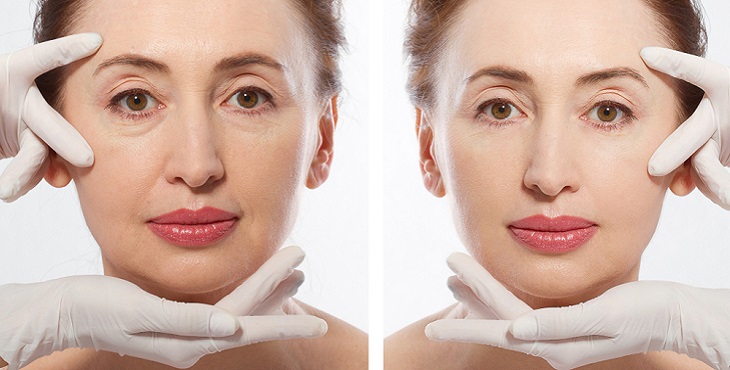 مراحل تغير الأنف بعد عملية التجميل