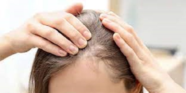 علاج الثعلبة بالقطران مجرب