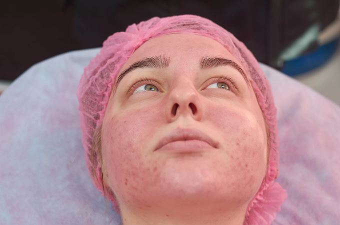 هل حقن البلازما تنفخ الوجه