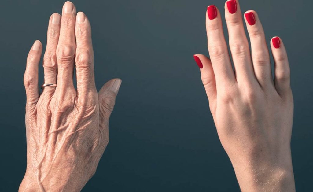 حقن بروفايلو لليدين