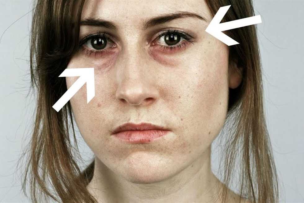 اسباب شحوب الوجه