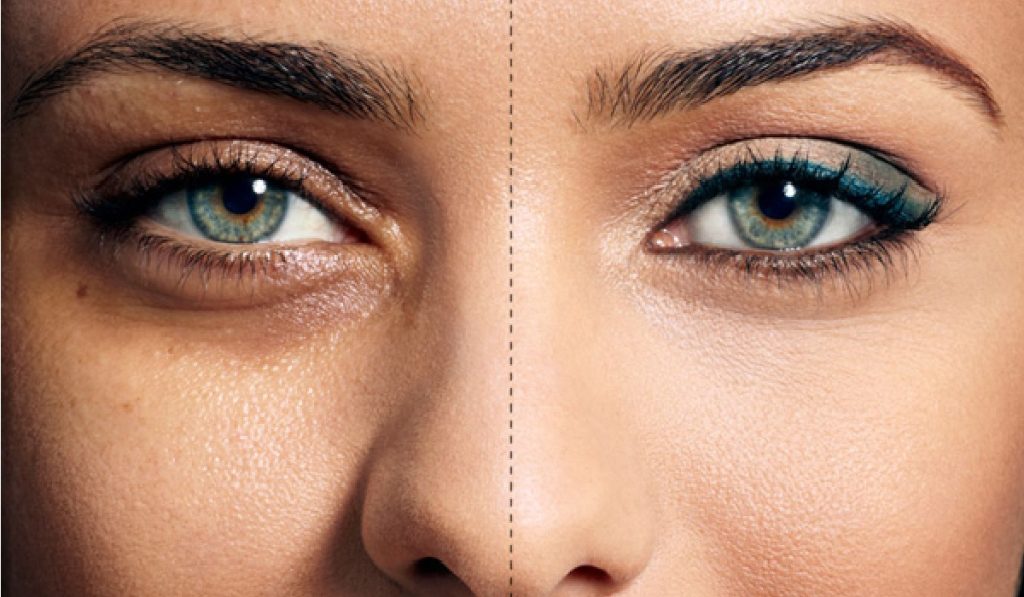 علاج شحوب الوجه والهالات السوداء