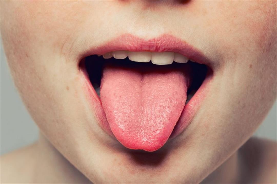 هل الحالة النفسية تؤثر على اللسان